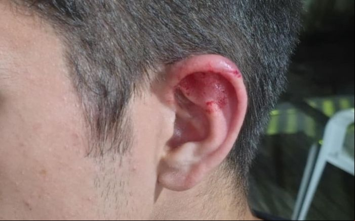 Motociclista chegou a perseguir o assaltante, mas acabou caindo da moto (Foto: Divulgação)