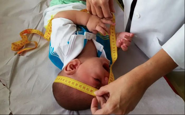 Famílias de crianças com síndrome do Zika vírus terão direito a indenização